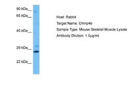 CHMP4B Antibody, Novus Biologicals 100 &mu;L | Buy Online | Novus Biologicals | Fisher Scientific